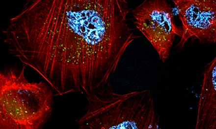 UNRC: Desarrollan nanopartículas que logran matar células cancerígenas
