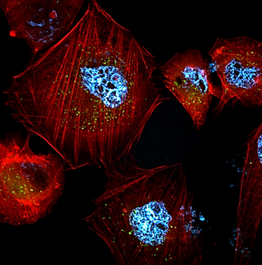 UNRC: Desarrollan nanopartículas que logran matar células cancerígenas