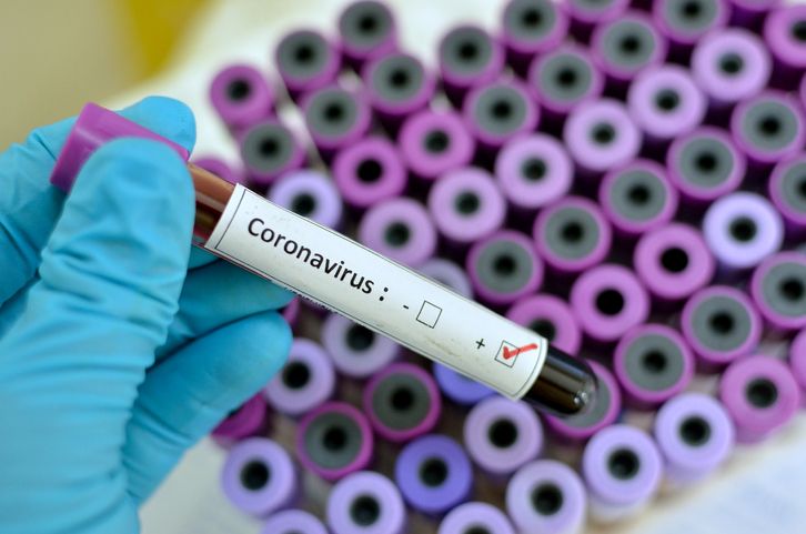 Se confirmó el primer caso positivo de Coronavirus en Río Cuarto